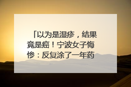 以为是湿疹，结果竟是癌！宁波女子悔惨：反复涂了一年药膏都没好！很多患者首诊都去了皮肤科